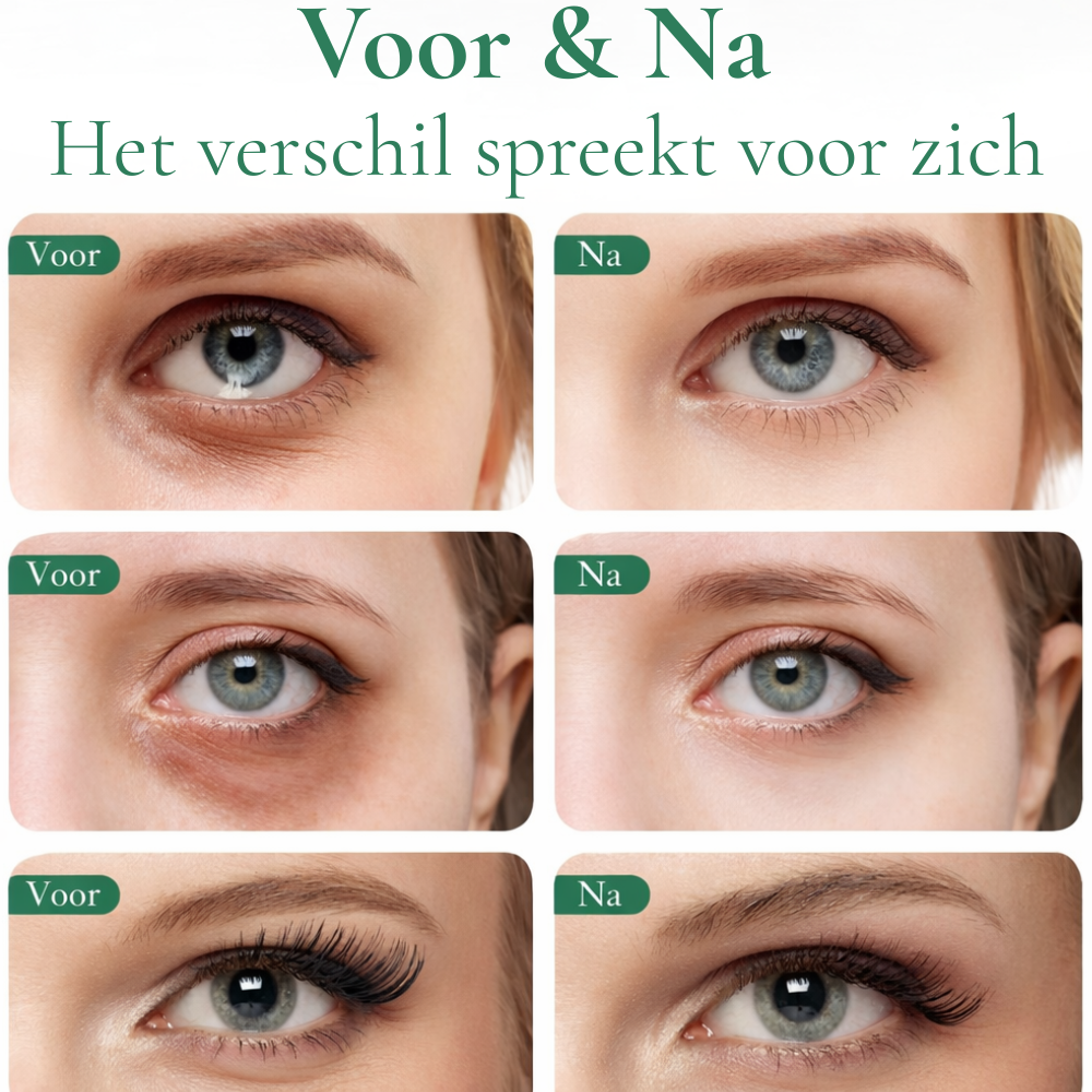 Avocado Eye Patches