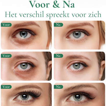 Avocado Eye Patches